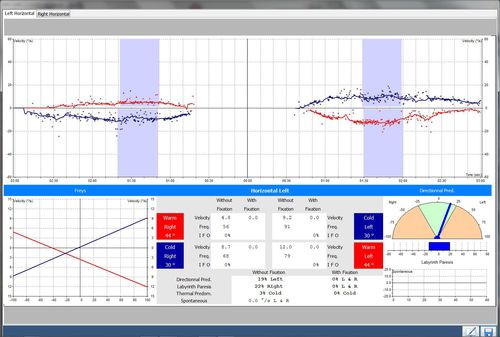 Программное обеспечение для контроля - EASY-Line  - Instrumentation DIFRA - для видеорегистрации / испытательное / учебное