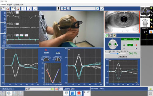 Испытательное программное обеспечение - Instrumentation DIFRA - вестибулярная реабилитация