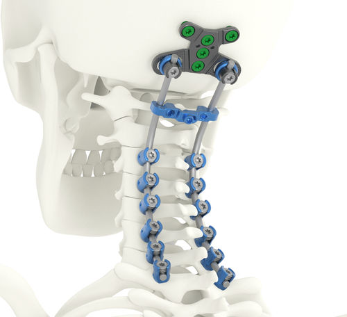Затылочно-шейно-грудная система остеосинтеза - SOLSTICE® - Life Spine - через задний отдел