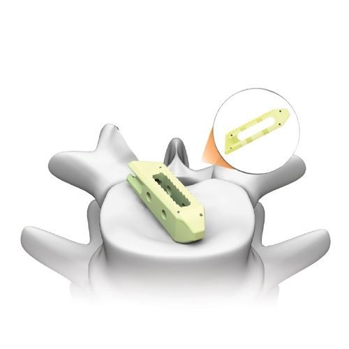 Межтеловой кейдж для поясничной зоны - PLATEAU®-LO - Life Spine - трансфораминальный доступ / косой разрез
