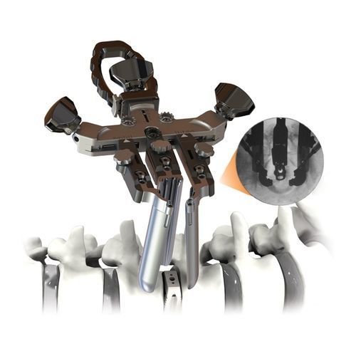 Расширитель для ортопедической хирургии - CENTRIC® - Life Spine - анатомический