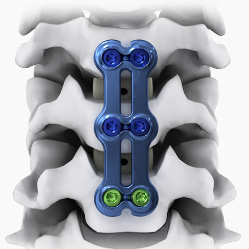 Костная пластина для артродеза шеи - NEO®-SL - Life Spine - блокируемая / металлическая / 2 уровня