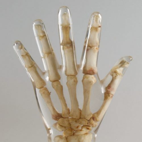 Тест-фантом для радиографии - 12711 - QUART X-Ray QA Solutions - для флюороскопии / кисти руки