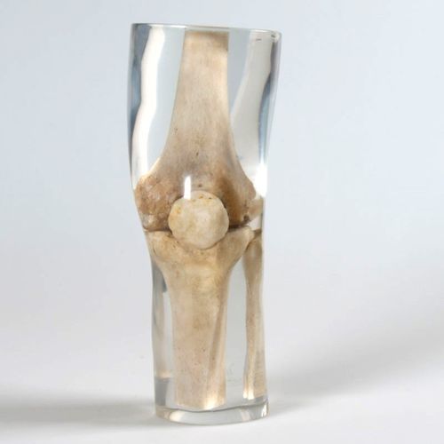 Тест-фантом для радиографии - 12714 - QUART X-Ray QA Solutions - нога / для колена / бедренной кости