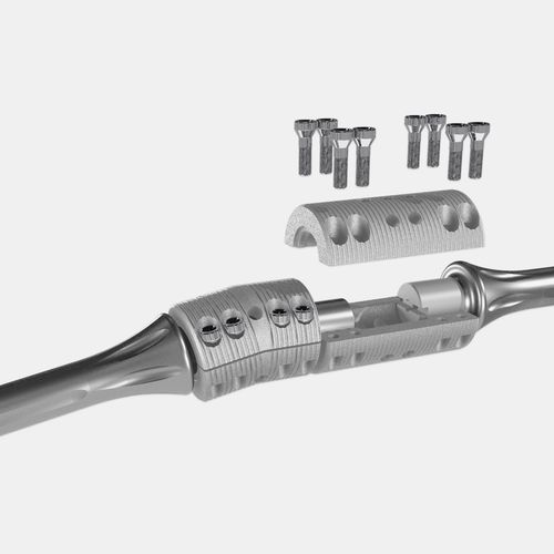 Интрамедуллярный штифт бедренная кость - OsteoBridge™ - Merete - большеберцовая кость / плечевая кость / из титана