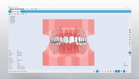 Программное обеспечение CAO - Studio - AGE Solutions - для визуализации 3D / ортодонтическое / для стоматологических лабoраторий