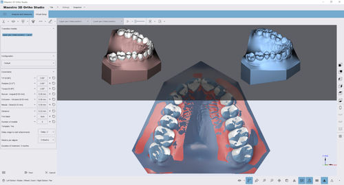 Программное обеспечение для анализа - Ortho Studio - AGE Solutions - для визуализации 3D / для измерений / для обработки