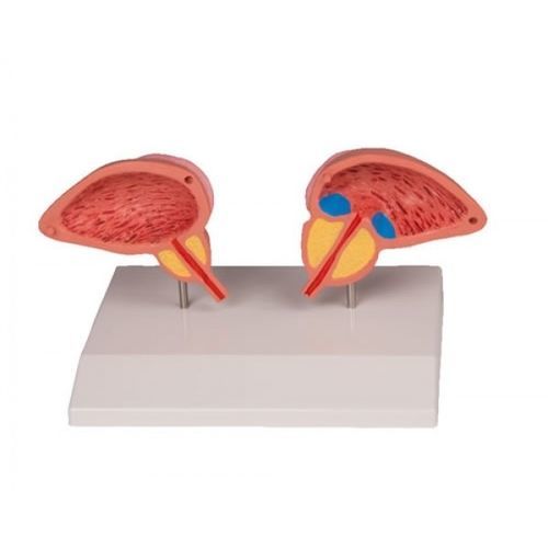 Анатомическая модель мочевого пузыря - ZKJ-166-M - Educational + Scientific Products Ltd - мочеиспускательного канала / уретральная / простаты