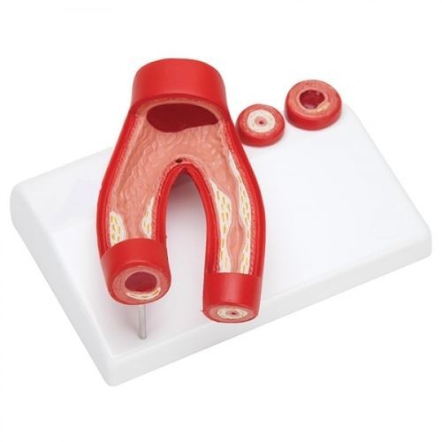 Анатомическая модель артерии - ZKJ-680-A - Educational + Scientific Products Ltd