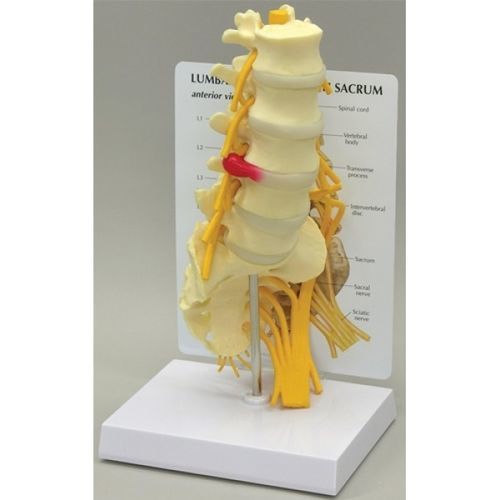 Анатомическая модель для поясничной зоны - GBM-036 - Educational + Scientific Products Ltd - нерва / ребра / крестца