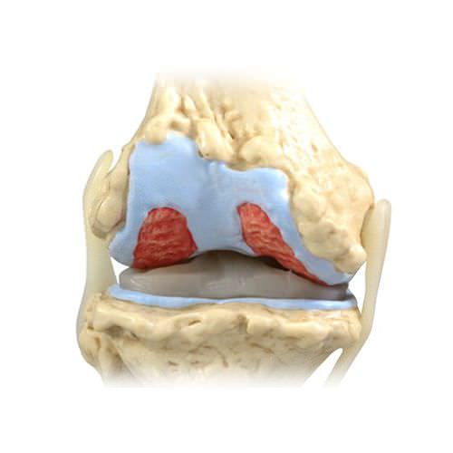 Анатомическая модель сустава - 1100 - GPI Anatomicals - для колена / для образовательных целей