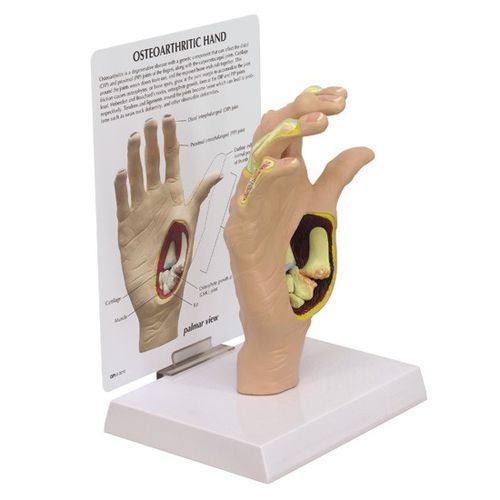 Анатомическая модель кости - 1930 - GPI Anatomicals - сустава / кисти руки / для образовательных целей