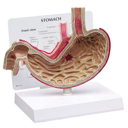 Анатомическая модель желудка - 2000 - GPI Anatomicals - дуоденальная / пищеводная / для образовательных целей