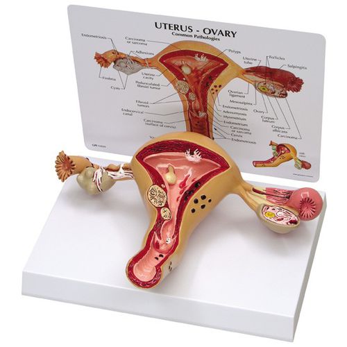 Анатомическая модель матки - 3480 - GPI Anatomicals - яичников / для образовательных целей / женская