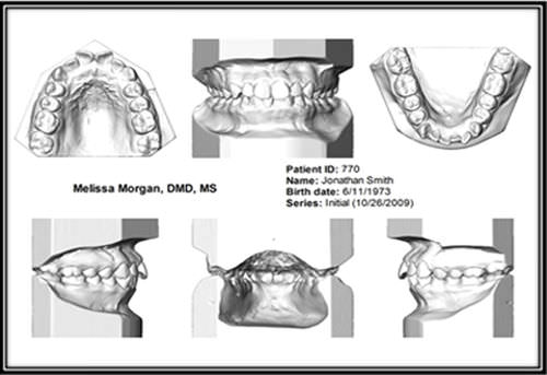 Программное обеспечение для проектирования зубных протезов - Ortho Insight 3D Full / Lite - Motion View Software - CAO / для визуализации 3D / для стоматологических лабoраторий