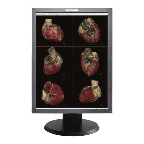 Медицинский монитор - C310S - Shenzhen Beacon Display Technology - для медицинских снимков / для диагностики / с высоким разрешением
