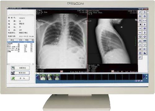 Медицинский монитор - C22W - Shenzhen Beacon Display Technology - 1920x1080 / 21,5" / светодиод