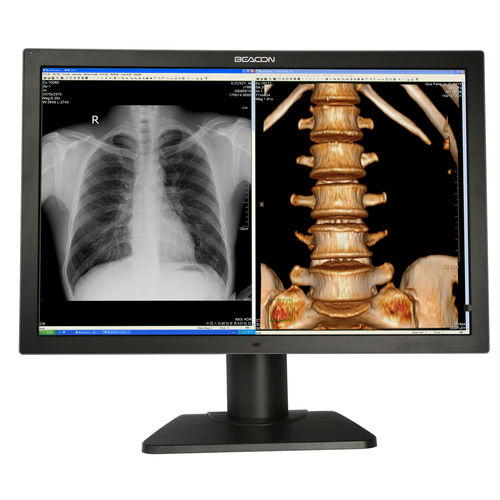 Медицинский монитор - C82W+ - Shenzhen Beacon Display Technology - для диагностики / Full HD / 3840×2160