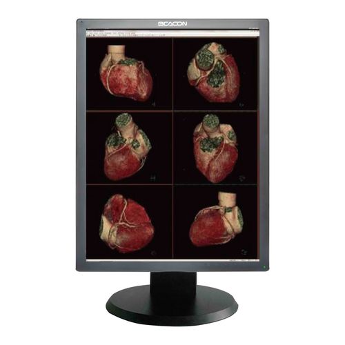 Медицинский монитор - C22S+ - Shenzhen Beacon Display Technology - для медицинских снимков / 21,3" / светодиод