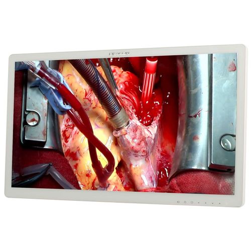 Медицинский монитор - S271P - Shenzhen Beacon Display Technology - хирургический / 1920x1080 / 27"
