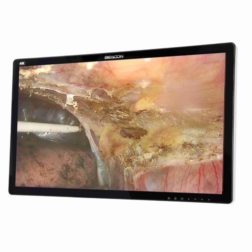 Медицинский монитор - S2785P - Shenzhen Beacon Display Technology - хирургический / разрешение 4K / 27"
