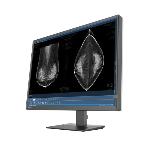 Медицинский монитор - C1216W - Shenzhen Beacon Display Technology - маммографический / для рентгенологии / с высоким разрешением