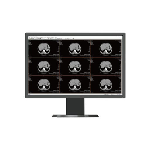 Медицинский монитор - HL2416SH - Shenzhen Beacon Display Technology - для рентгенологии / с высоким разрешением / 24"