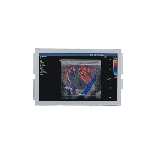 Медицинский монитор - U156W - Shenzhen Beacon Display Technology - для ультразвуковых исследований / 1920x1080 / 15,6"