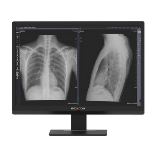 Медицинский монитор - C616W - Shenzhen Beacon Display Technology - с высоким разрешением / 30" / высокая степень освещенности