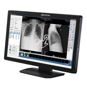 Медицинский монитор - C22WT - Shenzhen Beacon Display Technology - с высоким разрешением / 21,5" / светодиод