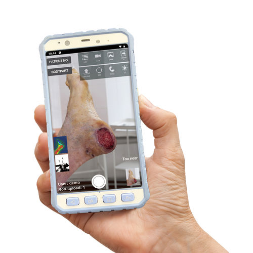 Приложение iOS для анализа - MPD100 - Medimaging Integrated Solution - для личных дел пациентов / кожа / с поддержкой ИИ