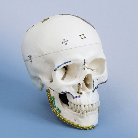 Компрессионная костная пластина для нижней челюсти - OPTIMUS - OSTEONIC - неблокируемая / металлическая