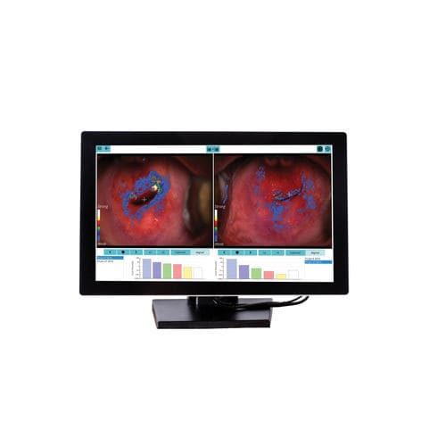 Программное обеспечение для анализа - DYSISmap - DySIS Medical - для управления / для обучения / для оценки