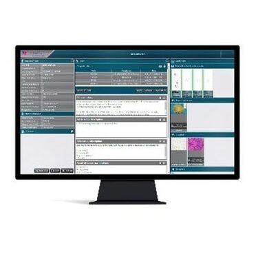 Система информации для лаборатории гистопатологии - CaseManager DX - 3DHISTECH Ltd. - для управления