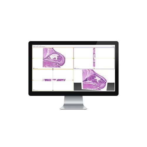 Медицинское программное обеспечение - 3DView - 3DHISTECH Ltd. - для контроля / 3D / 2D