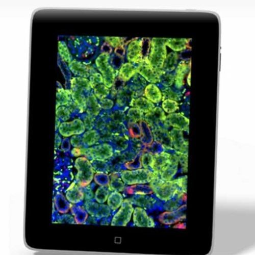 Приложение iOS для лаборатории гистопатологии - iPad Viewer - 3DHISTECH Ltd. - для виртуальной микроскопии / визуализатор / учебное