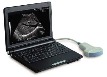 Переносной ультразвуковой сканер -  LEO-3000D1  - Xuzhou Leo Medical Equipments - для поливалентной эхографии / черно-белый