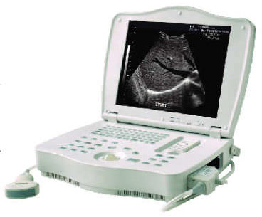 Переносной ультразвуковой сканер - LEO-3000E1  - Xuzhou Leo Medical Equipments - для поливалентной эхографии / черно-белый / со встроенной консолью