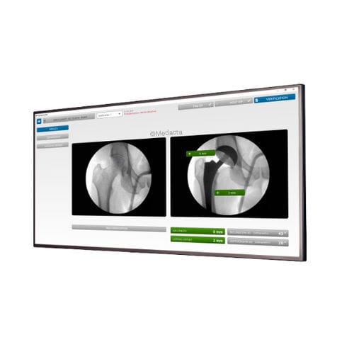 Программное обеспечение для хирургии тазобедренного сустава - MyHip® - Medacta - для проверки / для бедра / для планшетного ПК