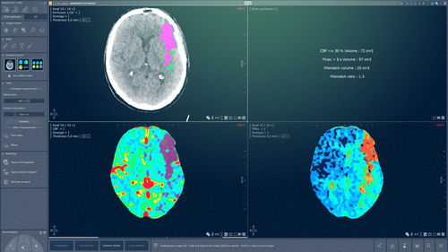Модуль программного обеспечения для анализа - MYRIAN® XP-BRAIN - Intrasense - для управления / для визуализации / для диагностики