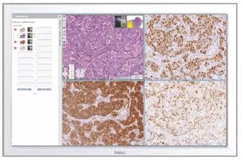 PACS для медицинских снимков - Aperio eSlide Manager - Leica Biosystems - для больницы / медицинская / клиническая