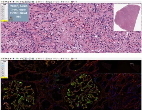 Медицинское программное обеспечение - Aperio ImageScope - Leica Biosystems - для лаборатории гистопатологии / для анализа изображений