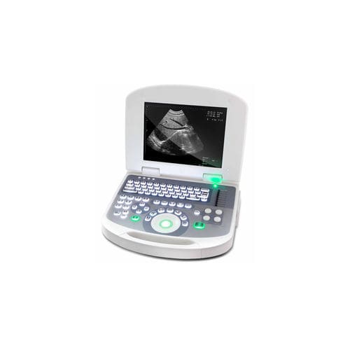 Переносной ультразвуковой сканер - 3W-2100 - Sunway Medical - для эхографии в акушерстве и гинекологии / для сердечно-сосудистой эхографии / для урологической эхографии