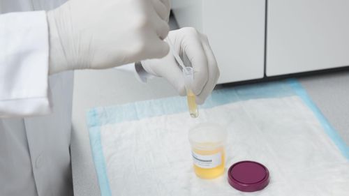 Набор для теста для фентанила - ARK™  - Siemens Healthineers - Laboratory Diagnostics - злоупотребление наркотиками / для мочи