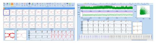 Программное обеспечение для анализа - CardioTrak  - Beneware Medical Equipment - для холтеровского монитора / медицинское