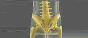 Тест-фантом для радиографии - RS-113T - Radiology Support Devices - таза