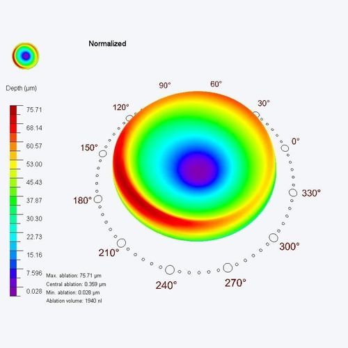 Медицинский модуль программного обеспечения - PresbyMAX® - SCHWIND eye-tech-solutions - для офтальмологии / для планирования лечения / глаза
