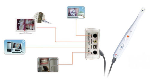 Интраоральная камера - CamAssist-----HDI-300/400A - Handy Technologies - цифровая / CCD