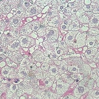 Реактив красящий раствор - P.A.S. – A  - BIO-OPTICA Milano - для цитологии / для гистологии