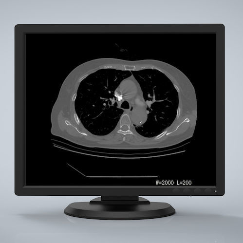 Медицинский монитор - R193G - Nanjing Jusha Display Technology - 1280x1024 / LCD / светодиод